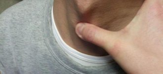 Где располагается щитовидный хрящ и что делать если болит гортань?