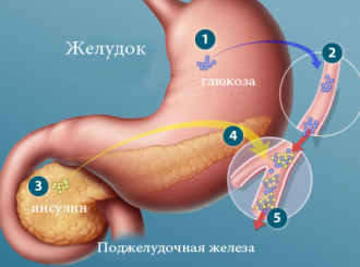 Норма и симптомы повышенного сахара в крови у детей
