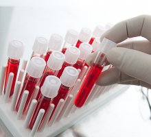 Показатели нормы сахара в крови у женщин и последствия колебания его уровня