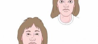 Как проявляется и лечится первичный гипотиреоз?