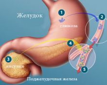 Причины и лечение повышенного инсулина в крови у людей