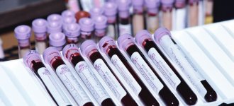 Причины повышенных антител к тиреоглобулину