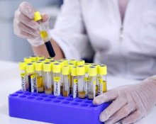 Функции гормона прогестерона в организме человека